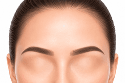 Brow lift