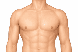 Gynecomastia