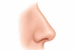 Rhinoplasty