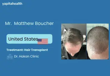 Matthew Boucher's Hair Transplant Success Story - Yapita Health