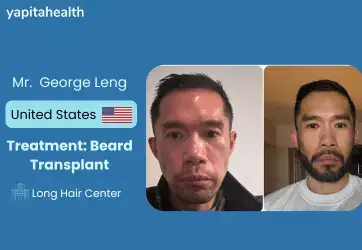 George Leng's Beard Transplant Journey - Yapita Health