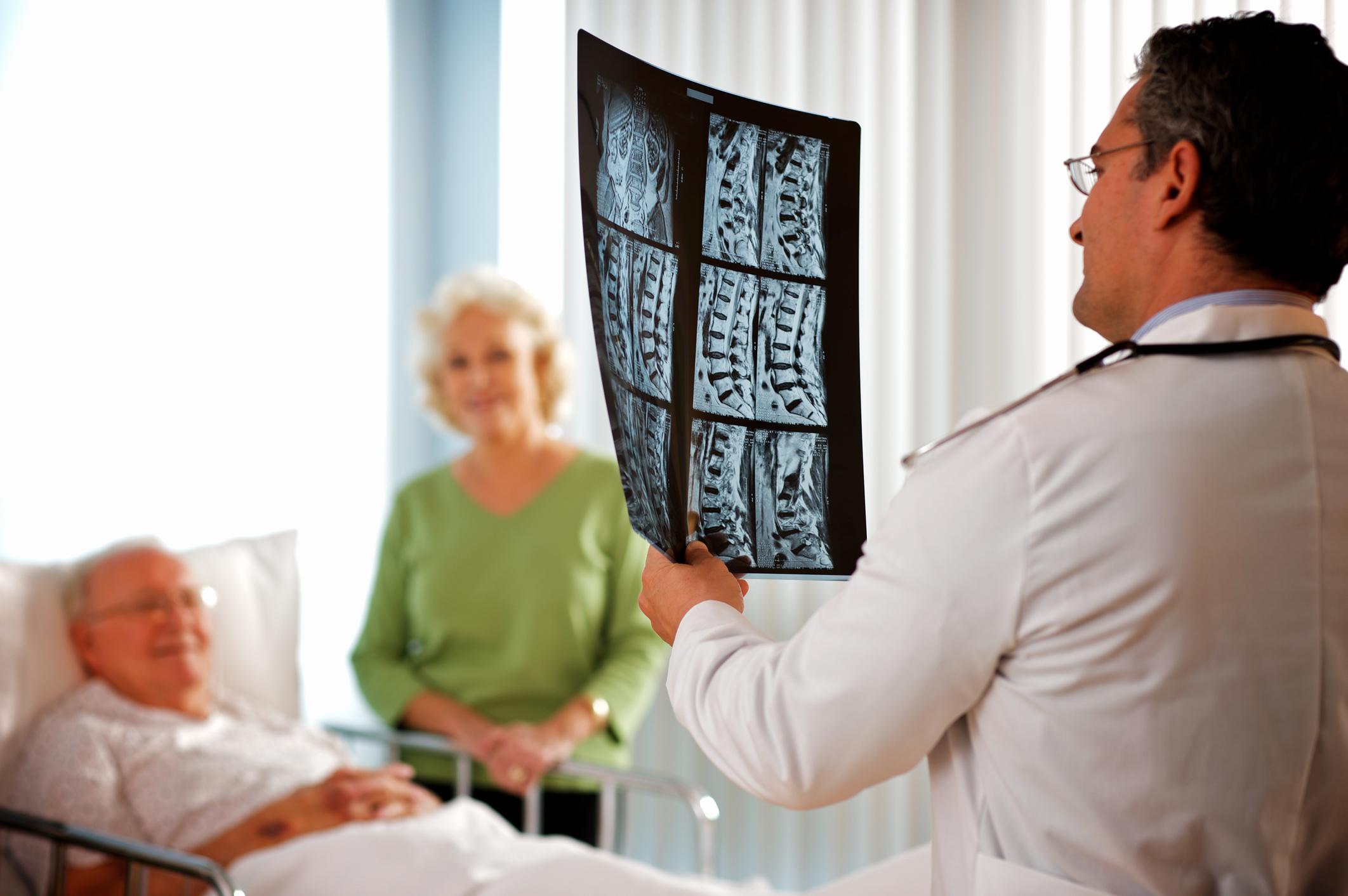 Kyphosis (Hunchback) Treatment