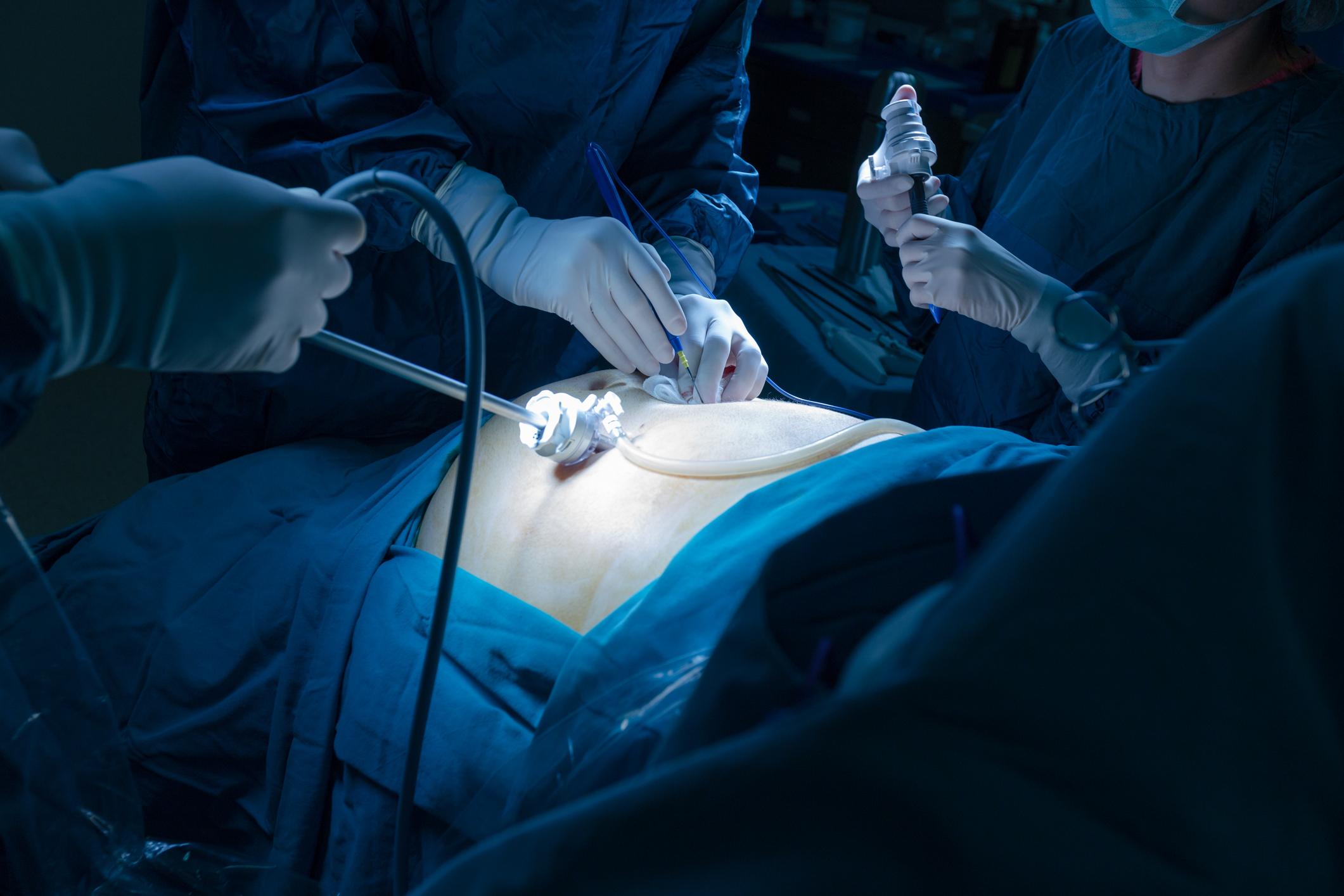 Spinal Endoscopic Surgery