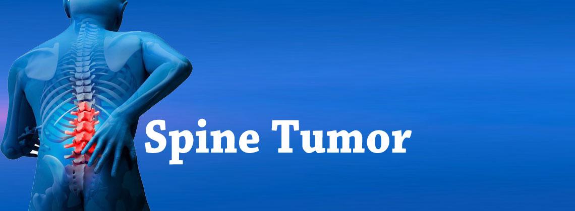 Spine Tumour Surgery