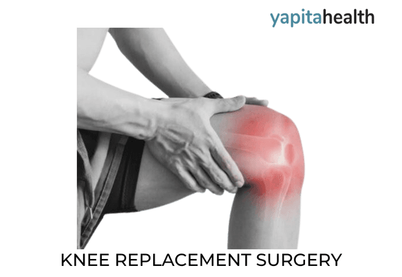 Knee Replacement Surgery