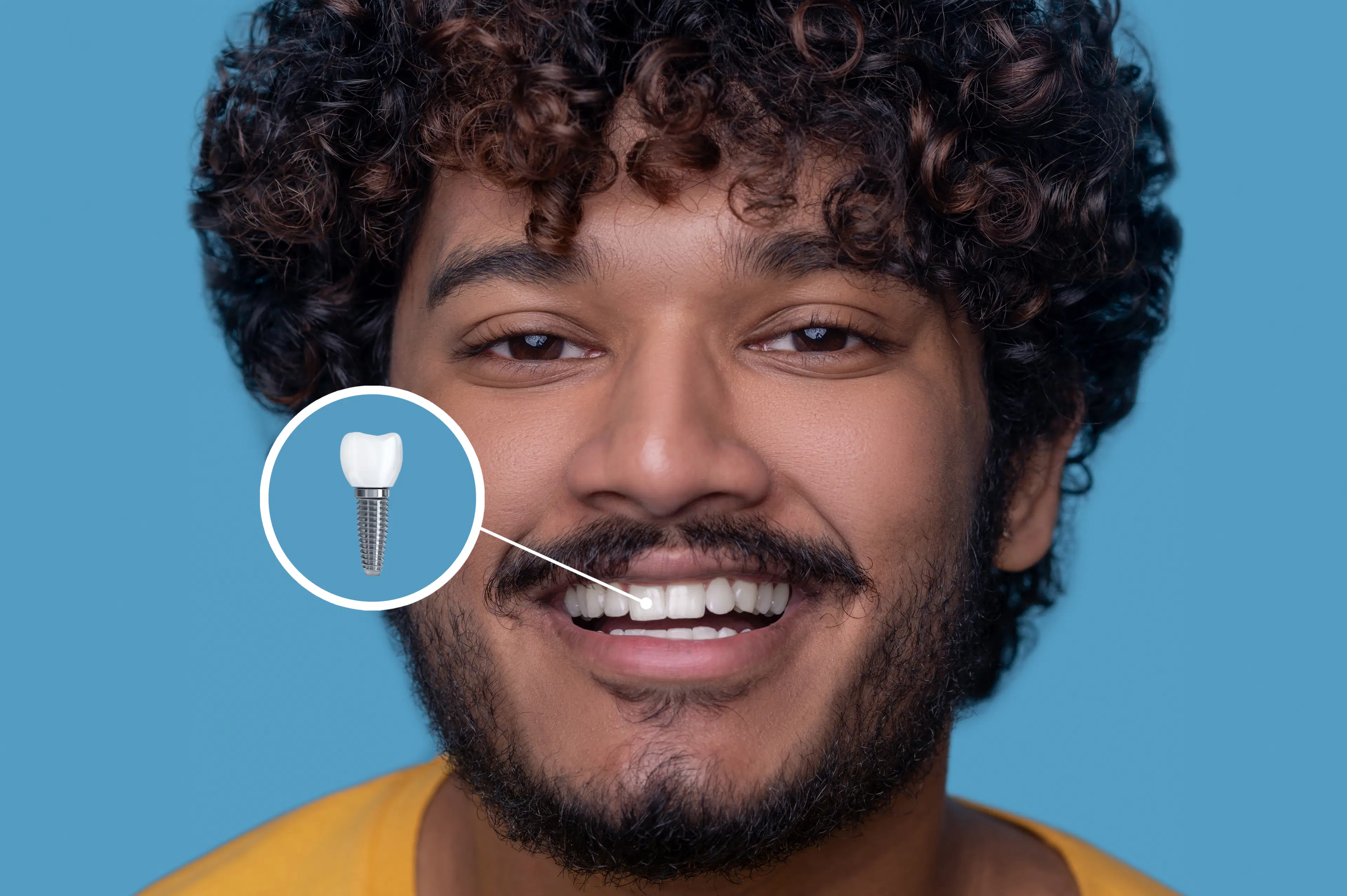 dental implants in Germany
