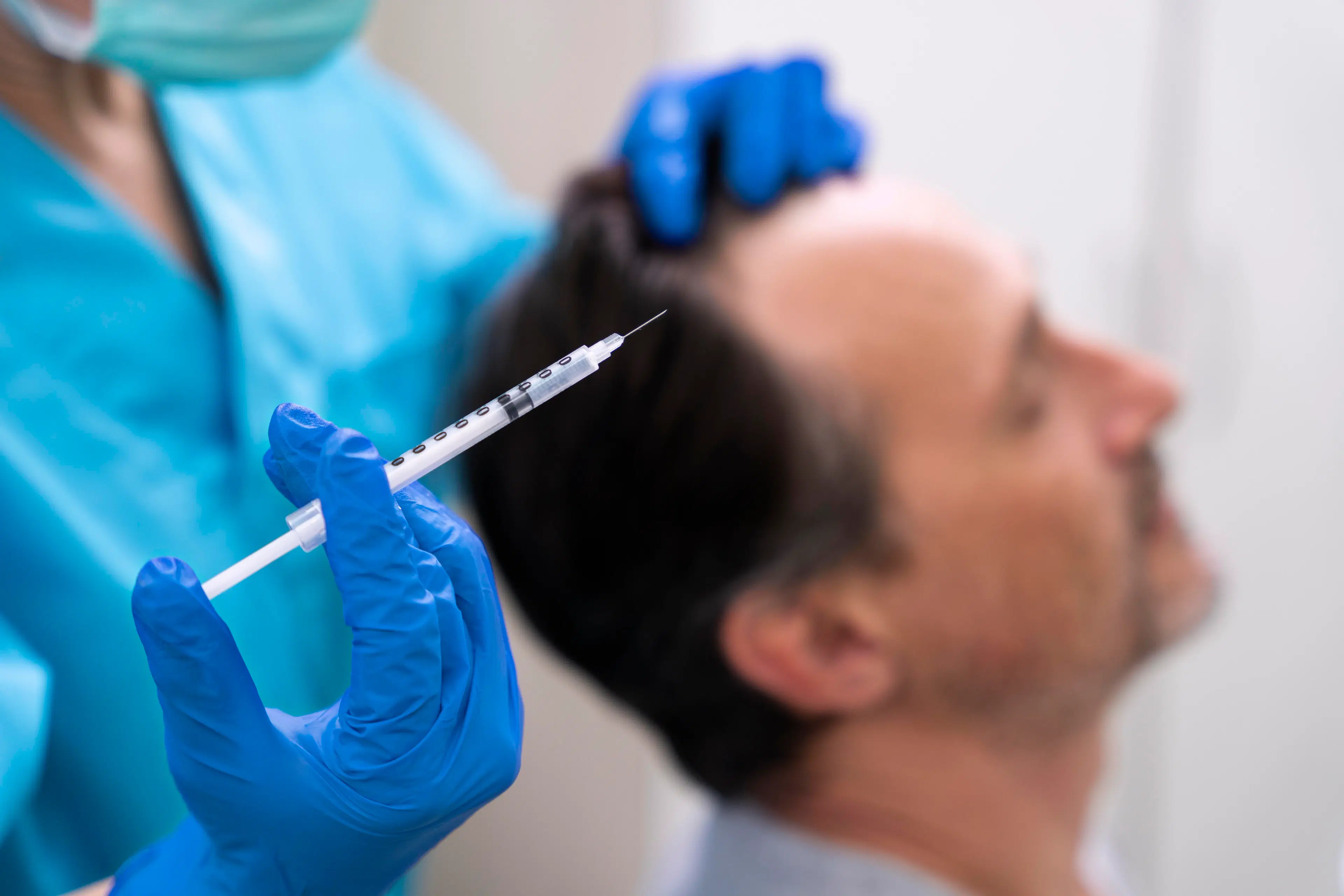 hair transplant in greenville