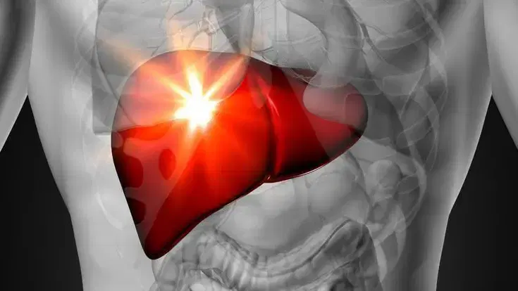 Liver Transplant at Max, New Delhi, India