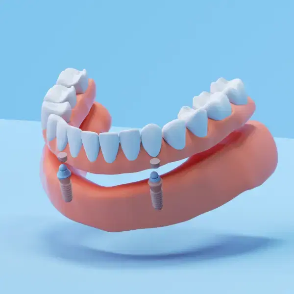 Dental Implant at Medicana Istanbul