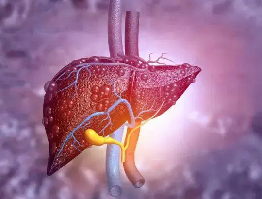 Liver Transplant at Apollo, Mumbai, India