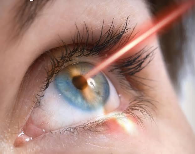LASIK (Both eye) Treatment at Medicana Istanbul