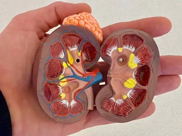 Kidney Transplant at Max Hospital, Saket, New Delhi, India