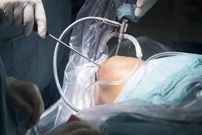 Knee Arthroscopy at Medcare, Dubai, UAE