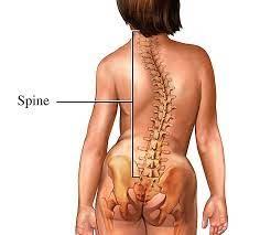 Scoliosis Spine Surgery at Artemis, Gurgaon, India