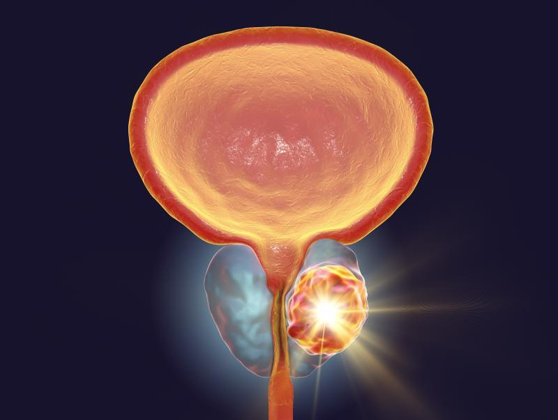 HOLEP Surgery at Fortis Memorial, Gurgaon, India