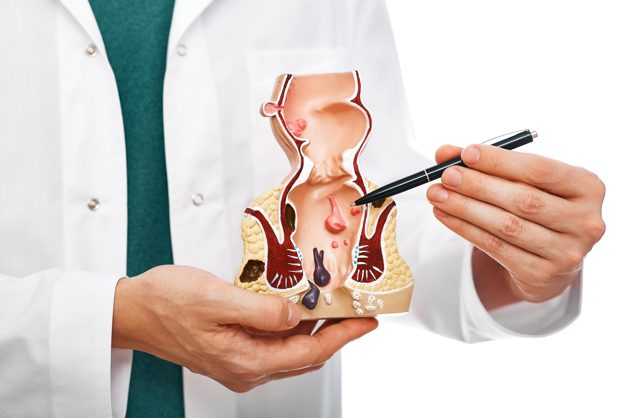 Hemorrhoidectomy at Artemis Hospital, Gurgaon