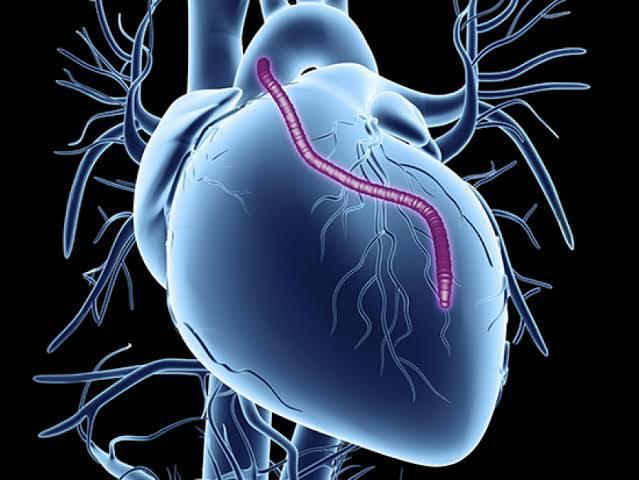 CABG at Medical Park