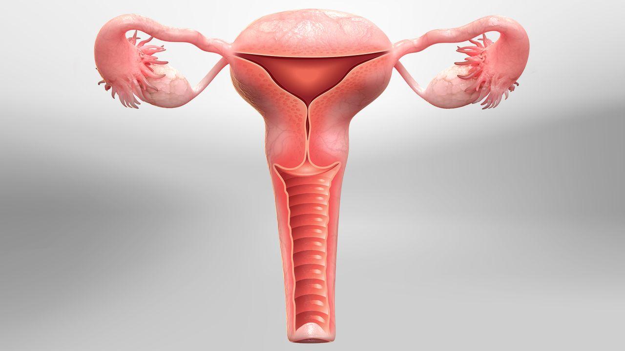 Laparoscopic Hysterectomy at Artemis Hospital, Gurgaon