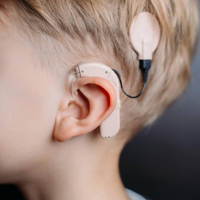 Unilateral Cochlear implantation Package at Medicana Istanbul