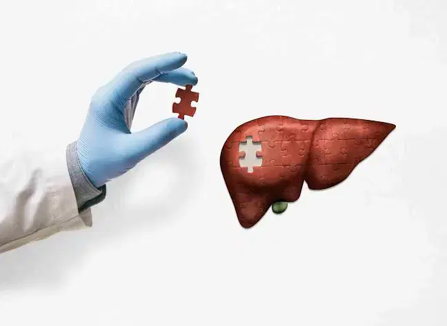 Liver Transplant at Max Hospital, Saket, New Delhi, India