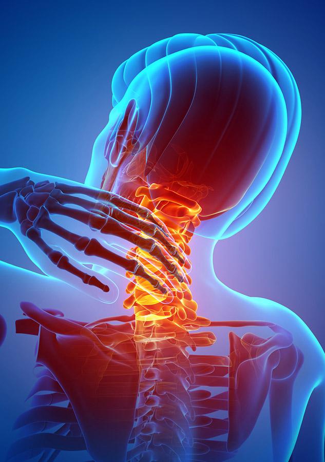 Anterior cervical discectomy and fusion (ACDF)