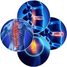 Anterior cervical discectomy and fusion (ACDF)