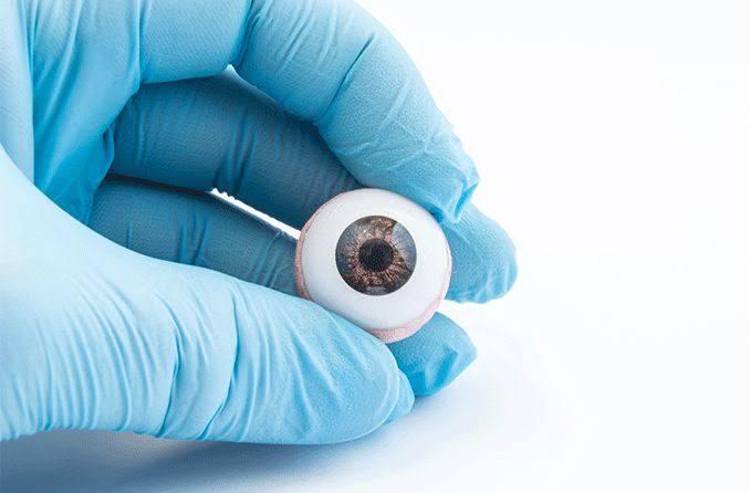 Cornea transplant at Saudi German, Dubai, UAE