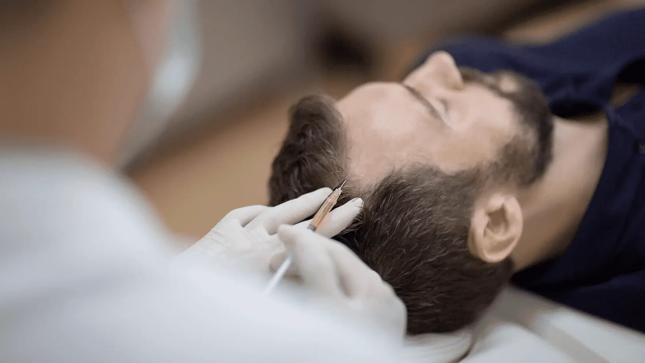 Hair Transplant at Clinicana, Istanbul, Turkey