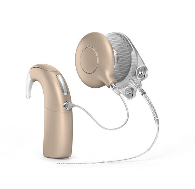 Unilateral Cochlear Implantation at Saudi German Hospital