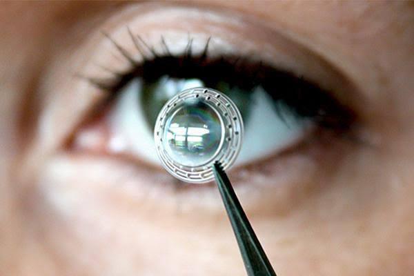 Cornea transplant (one eye) at Saudi German Hospital, Dubai