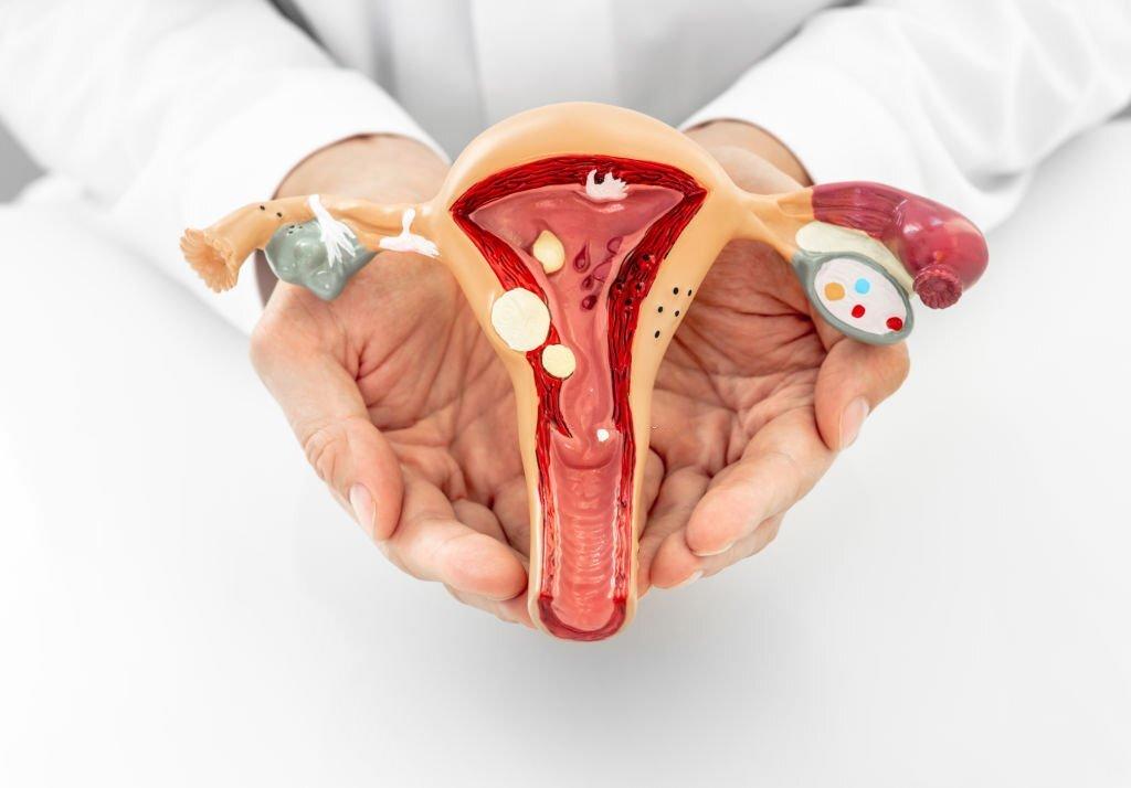 Laparoscopic Myomectomy at American Hospital, Istanbul