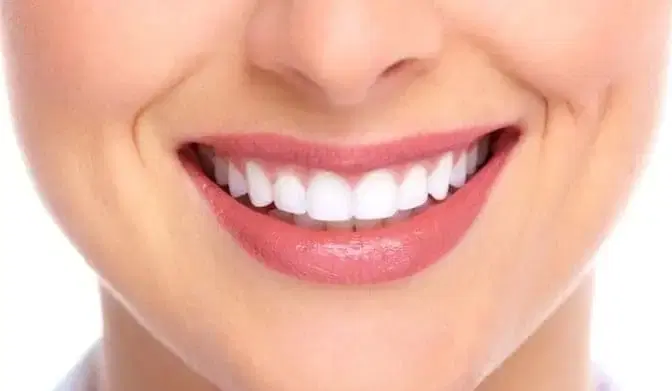 Dental Implants at Saudi German, Dubai