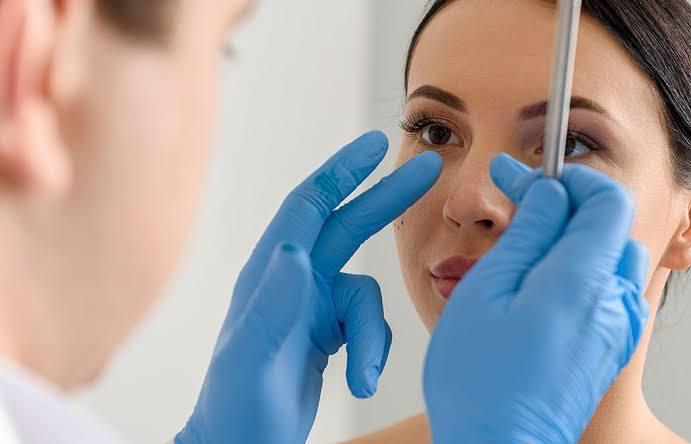 Cosmetic Rhinoplasty at Saudi German, Dubai, UAE