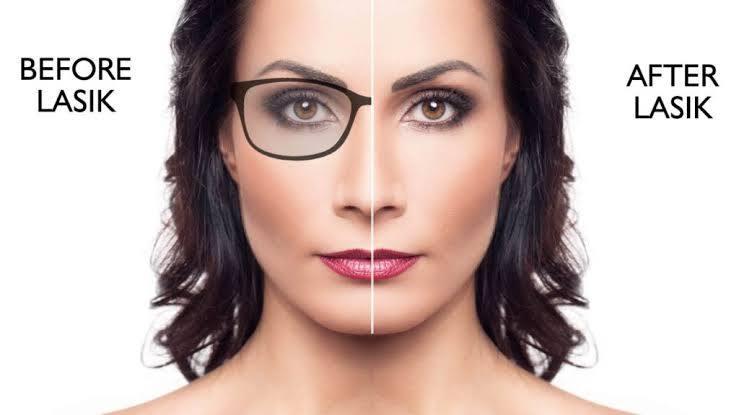 LASIK (Both eyes) treatment at Saudi German Hospital, Dubai