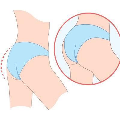 Brazilian Butt Lift at Medicana Istanbul